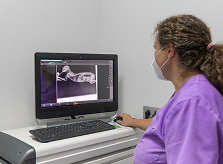 woman viewing xray on computer